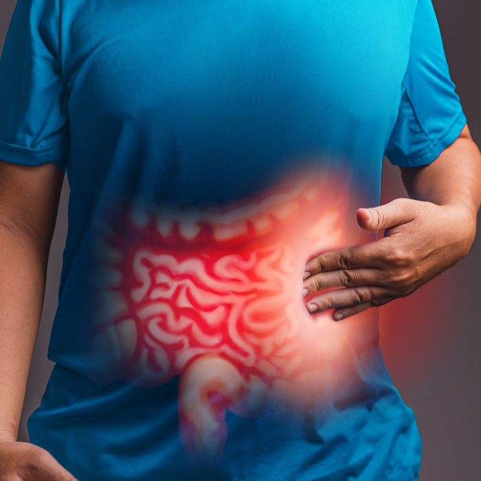 Cirurgia de Intestino